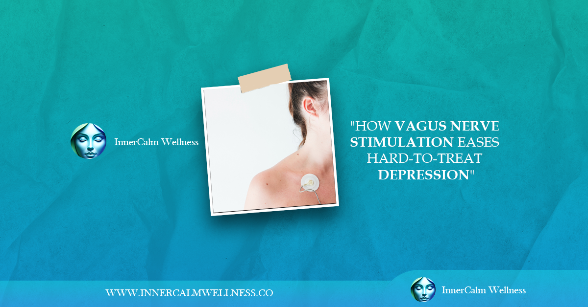 How Vagus Nerve Stimulation Eases Hard to Treat Depression